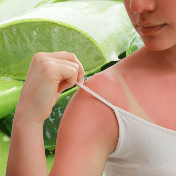 Why Aloe Vera is Your Skin's Best Ally for Sunburn Relief