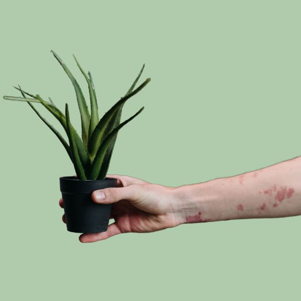 How to Use Aloe Vera to Fade Scars Naturally: Tips and Tricks